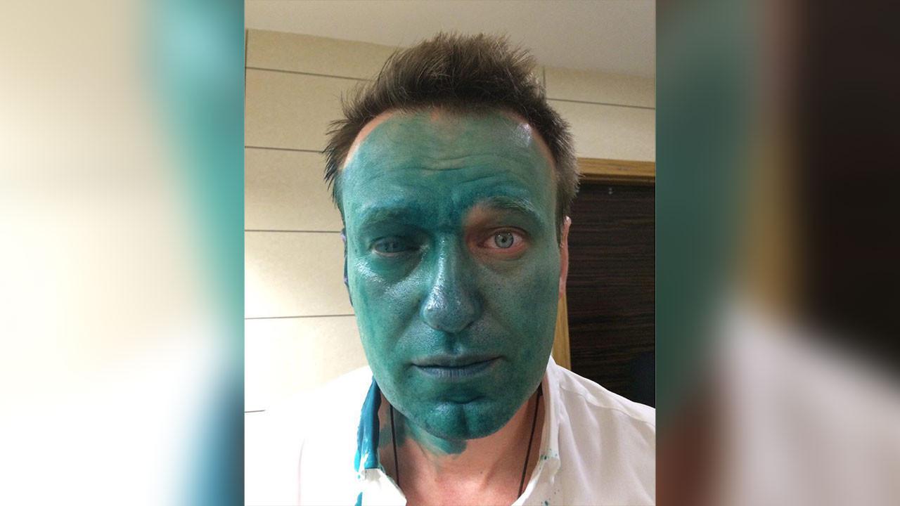 навального облили зеленкой